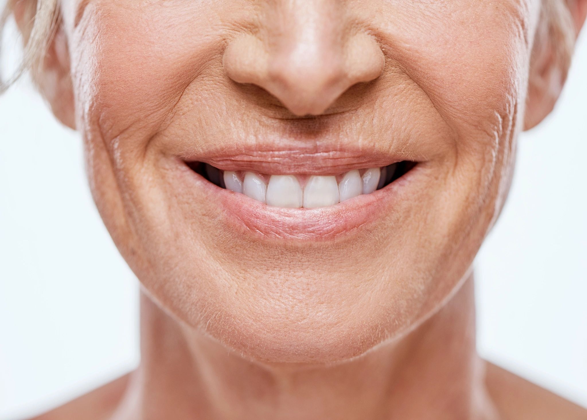 Detalhe de sorriso feminino com estética harmoniosa